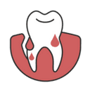 Bleeding gums