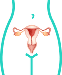 Gynecological diseases