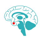 pituitary adenoma