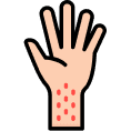 Skin diseases